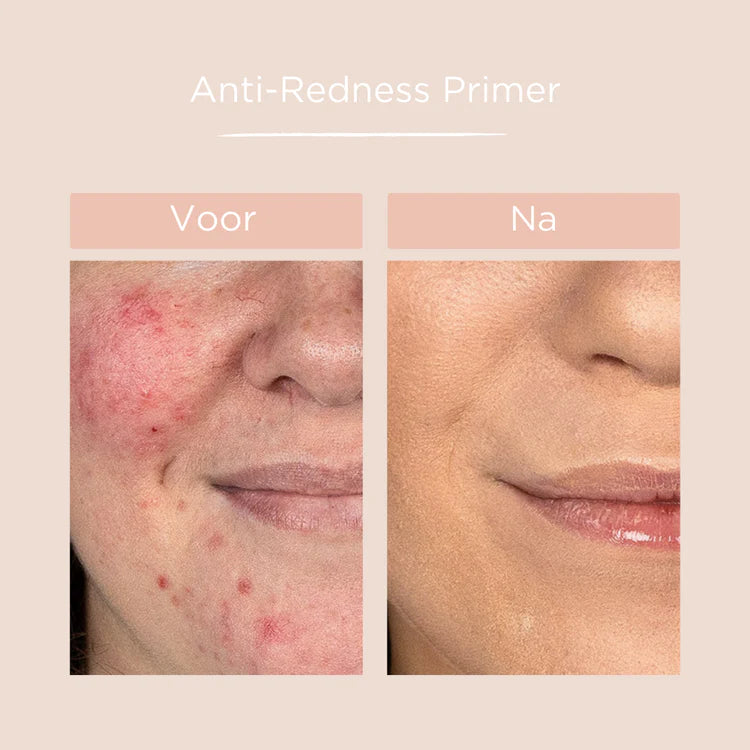 Anti-Redness Primer